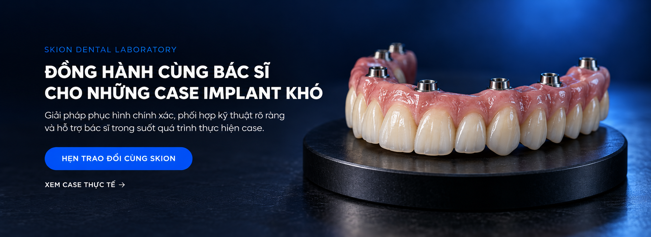 SKION Dental Laboratory